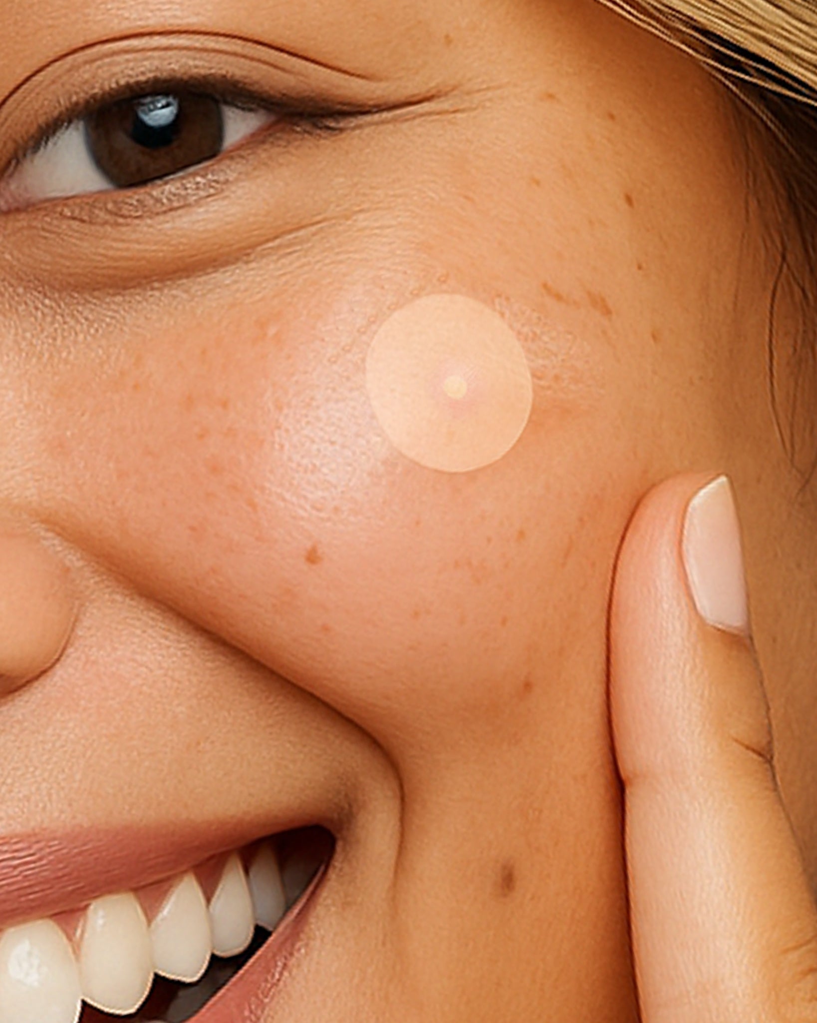 HydroColloid Acne Clear Patch