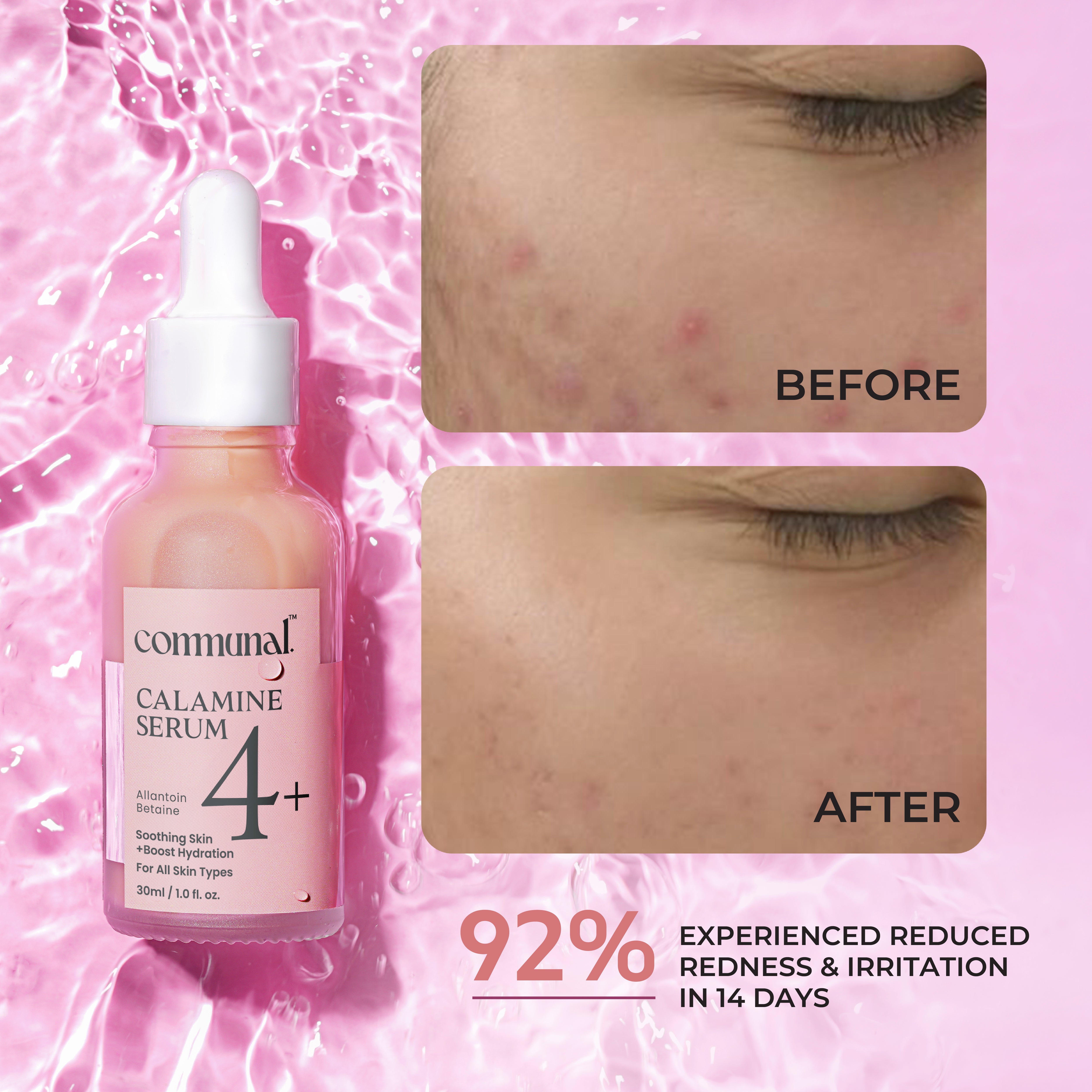 Calamine Face Serum